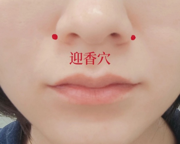 迎香穴_副本.jpg